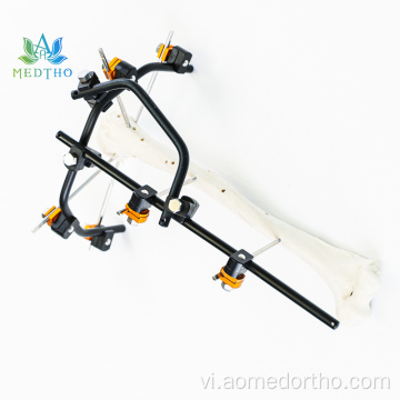 Điều trị gãy xương humerus